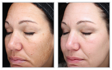 Load image into Gallery viewer, BBL/Fractional Stack