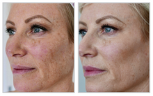 Load image into Gallery viewer, BBL/Fractional Stack