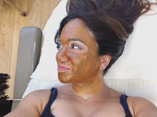 Load image into Gallery viewer, The Cosmelan® Method for Hyperpigmentation