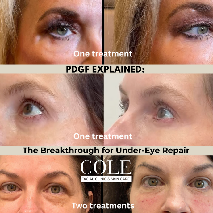 The Science Behind PDGF Under the Eyes