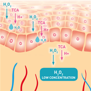 PRX Derm Perfexion - 5 treatments w/ hydrating treatment & dermaplane.