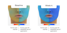 Load image into Gallery viewer, HA (Hyaluronic Acid) IMMERSE Serum™
